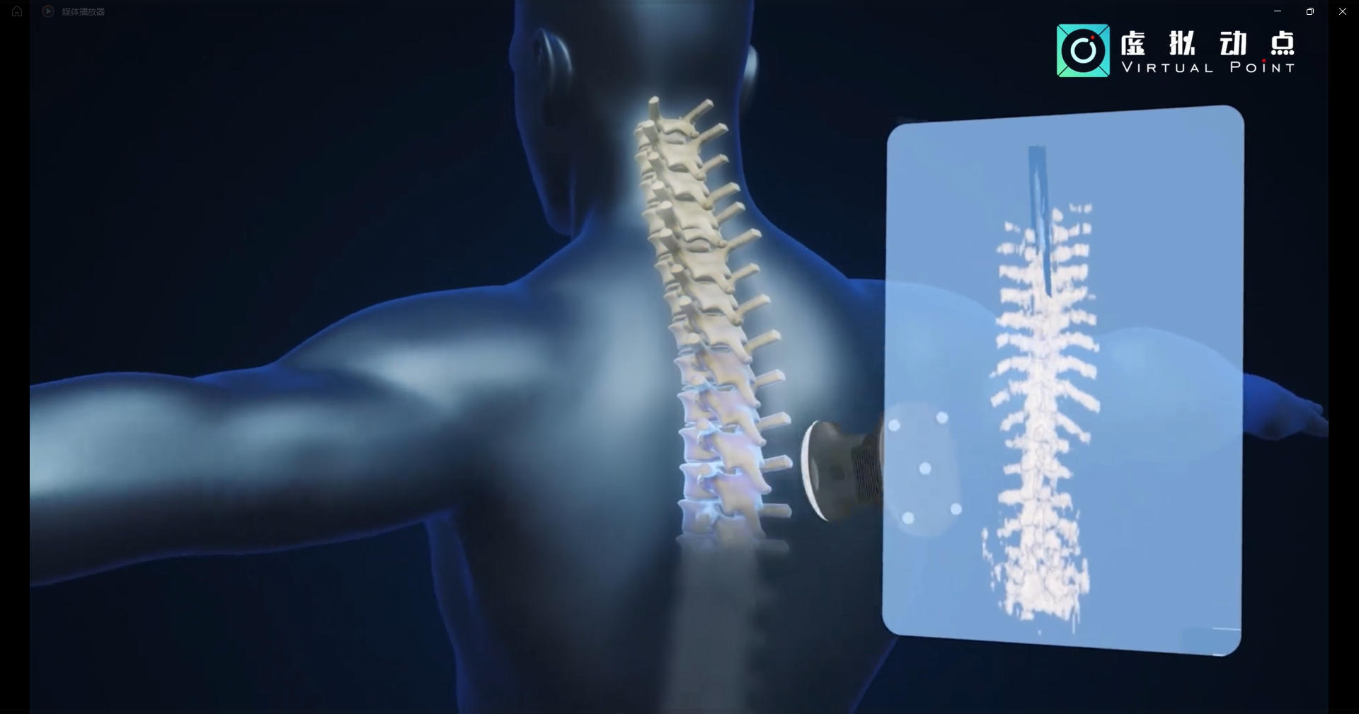 jinnianhui官网金年会·虚拟动点OptiTrack开创3D超声成像在脊柱诊断中的应用